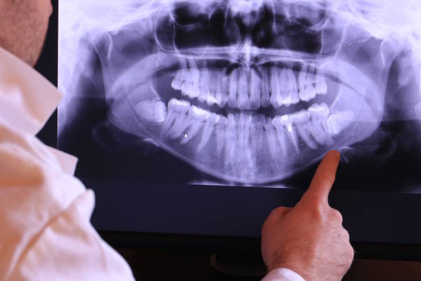 Best Holiday Emergency Dentist in Morgandale, OH