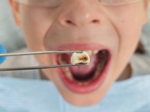 Best Holiday Emergency Dentist in Morgandale, OH